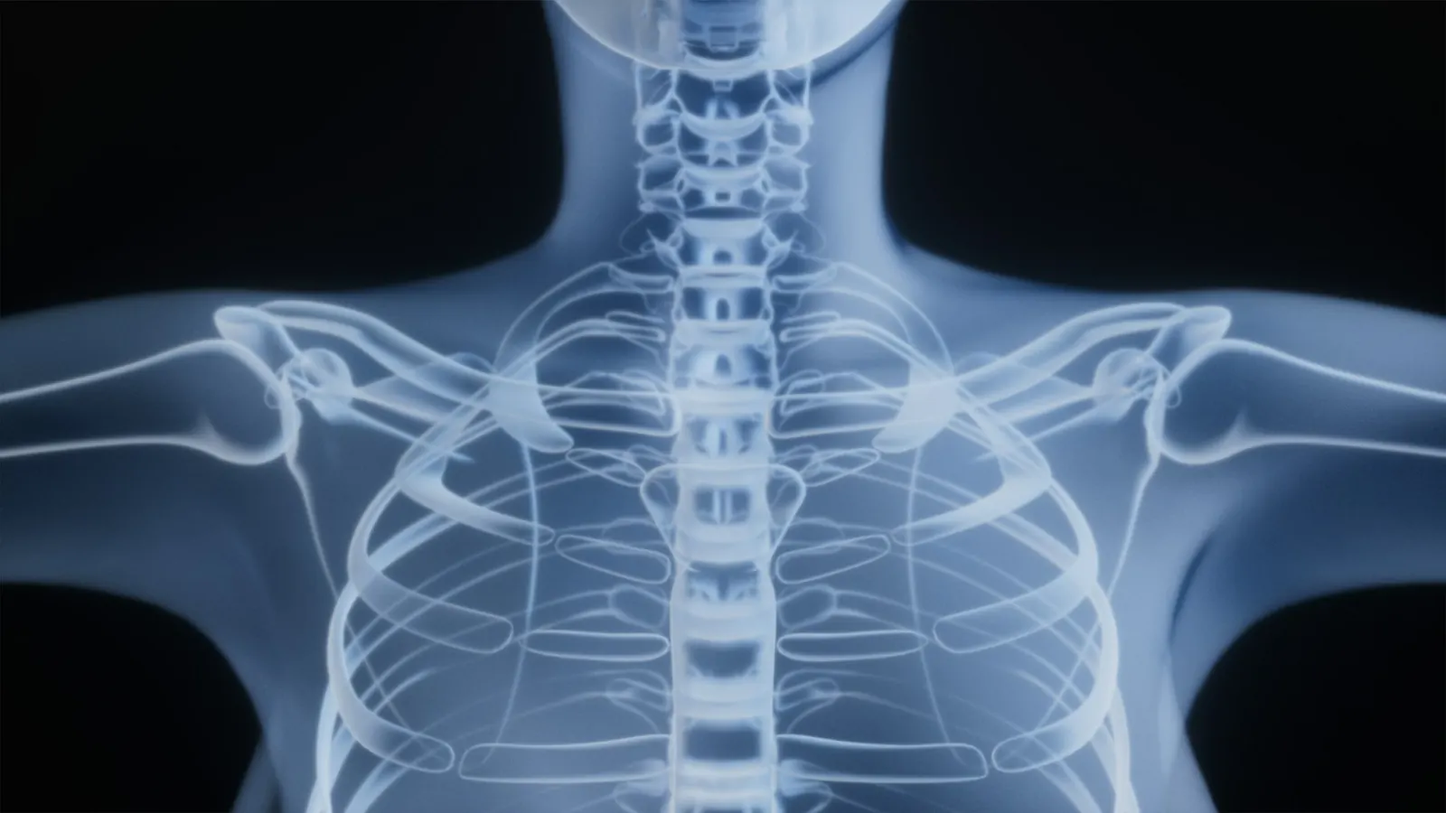 X-ray image of the spine, neck and shoulders